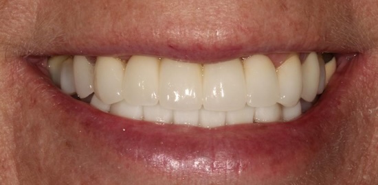 smile gallery image