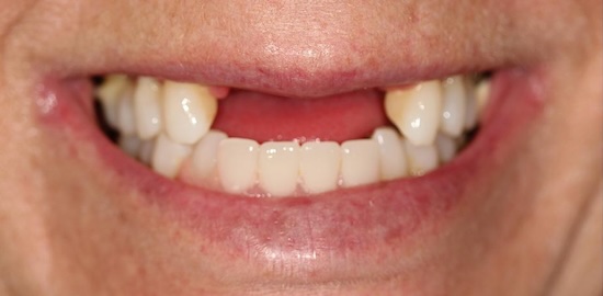 smile gallery image