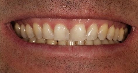 smile gallery image