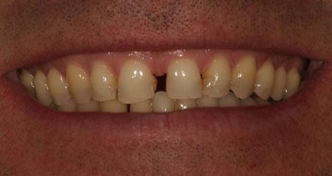 smile gallery image
