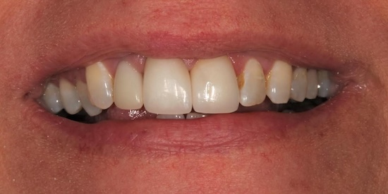 smile gallery image