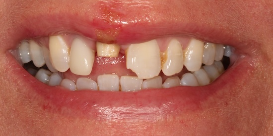 smile gallery image