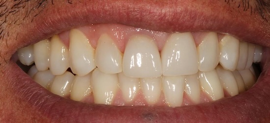 smile gallery image