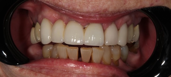 smile gallery image
