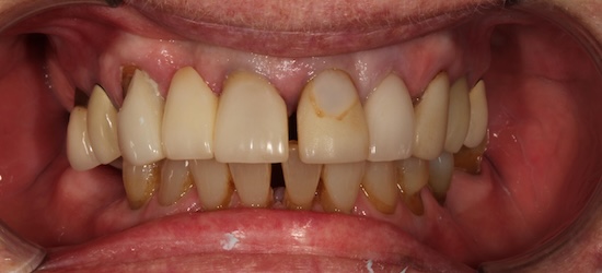 smile gallery image