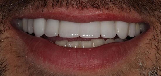 smile gallery image