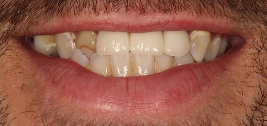 smile gallery image