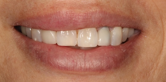 smile gallery image