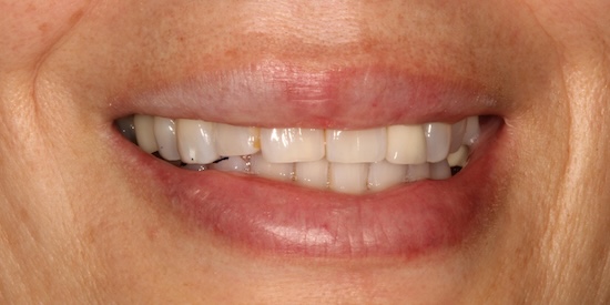 smile gallery image