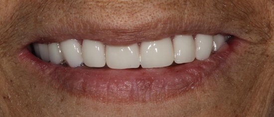 smile gallery image