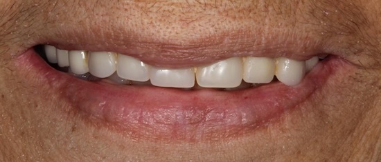 smile gallery image