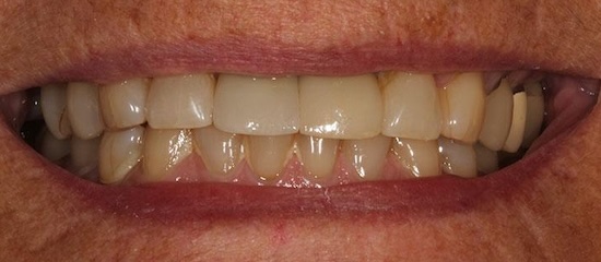 smile gallery image