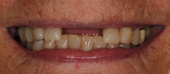 smile gallery image