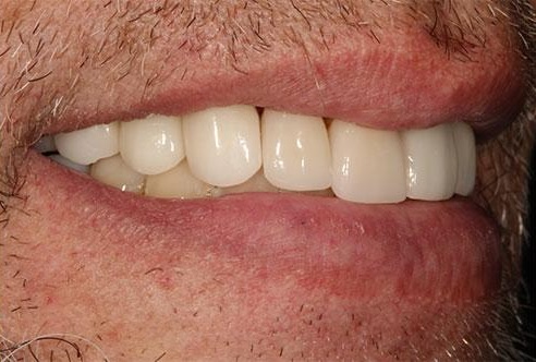 smile gallery image