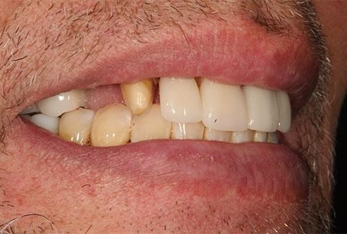 smile gallery image