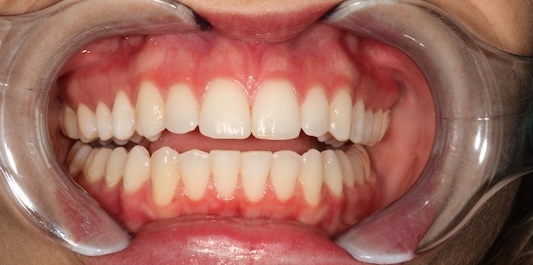 smile gallery image