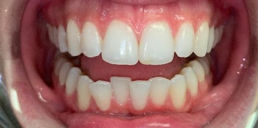 smile gallery image