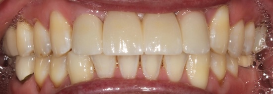 smile gallery image