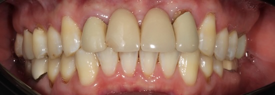 smile gallery image