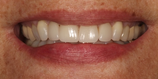smile gallery image