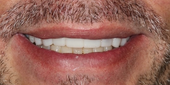 smile gallery image