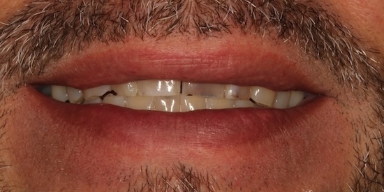 smile gallery image