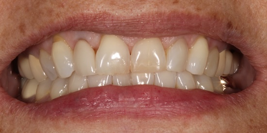 smile gallery image
