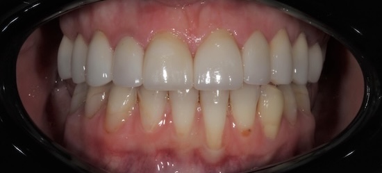 smile gallery image