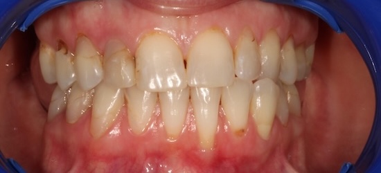 smile gallery image