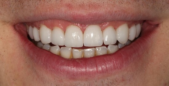 smile gallery image