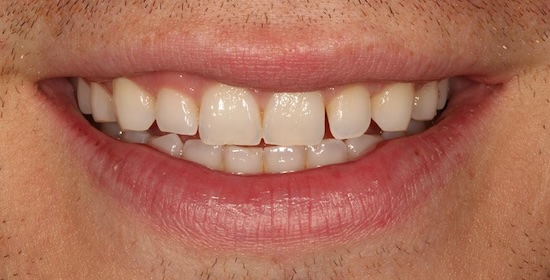 smile gallery image