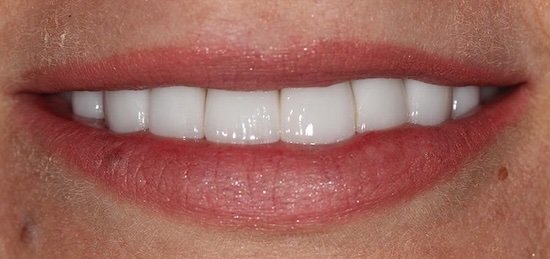 smile gallery image