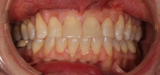 smile gallery image