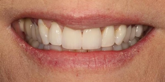 smile gallery image