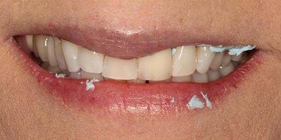 smile gallery image