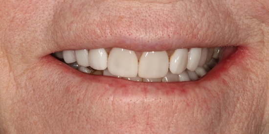 smile gallery image