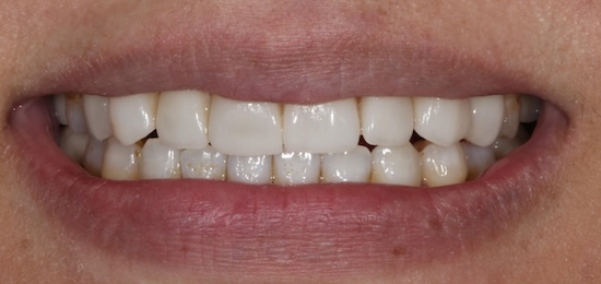 smile gallery image