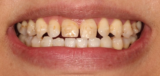 smile gallery image