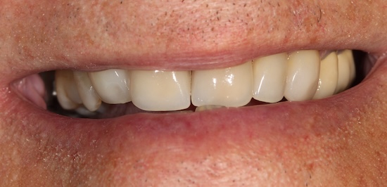 smile gallery image