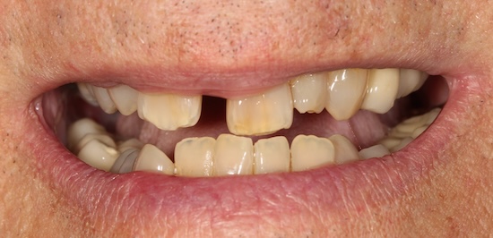 smile gallery image