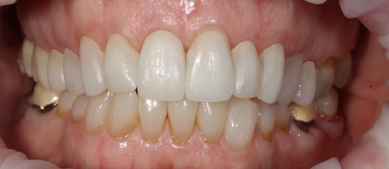 smile gallery image
