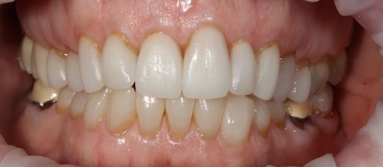 smile gallery image