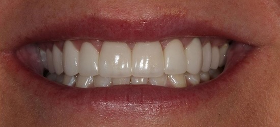 smile gallery image