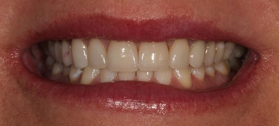 smile gallery image