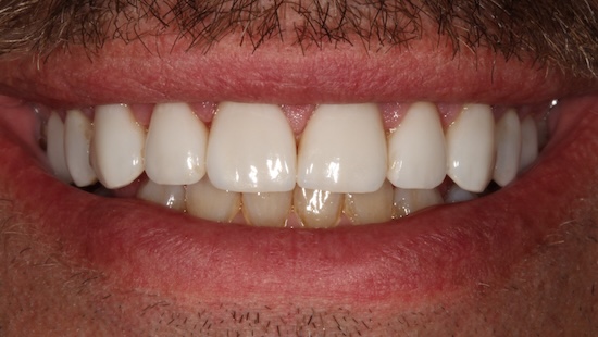 smile gallery image