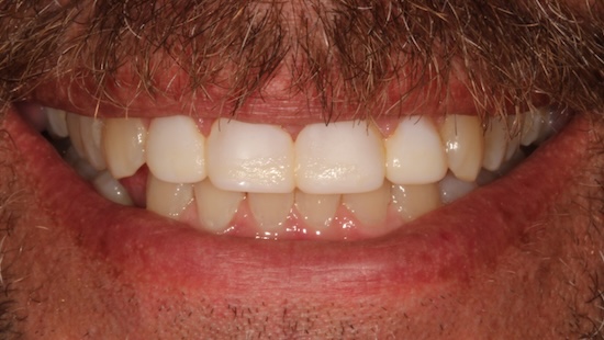 smile gallery image