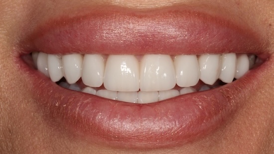 smile gallery image