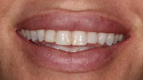 smile gallery image
